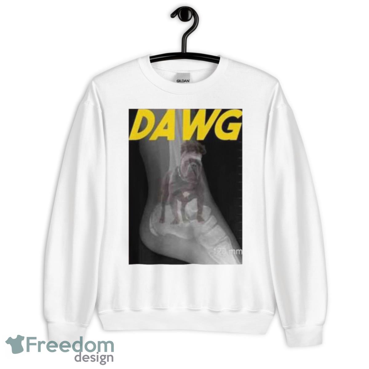Patrick Mahomes Dawg Ankle X Ray Football Shirt - Unisex Heavy Blend Crewneck Sweatshirt